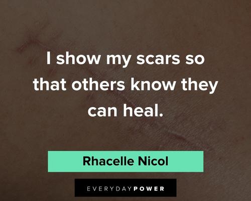 scars quotes that others know they can heal