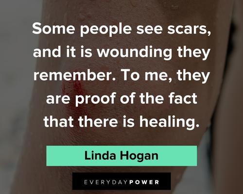 scars quotes about some people see scars